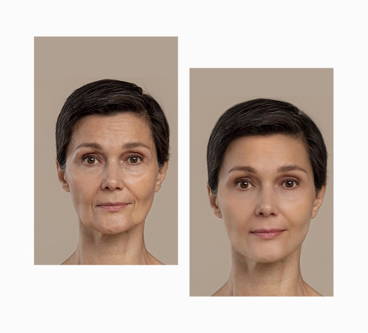 Face Sculpting Procedures